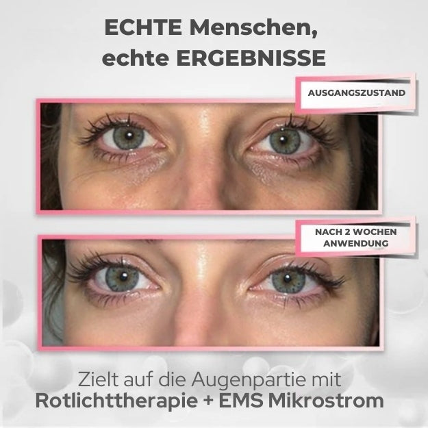 PODOeye™ Verjüngende Rotlicht-Therapie für die Augenpartie