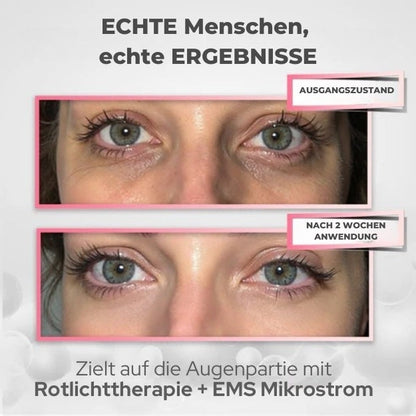 PODOeye™ Verjüngende Rotlicht-Therapie für die Augenpartie